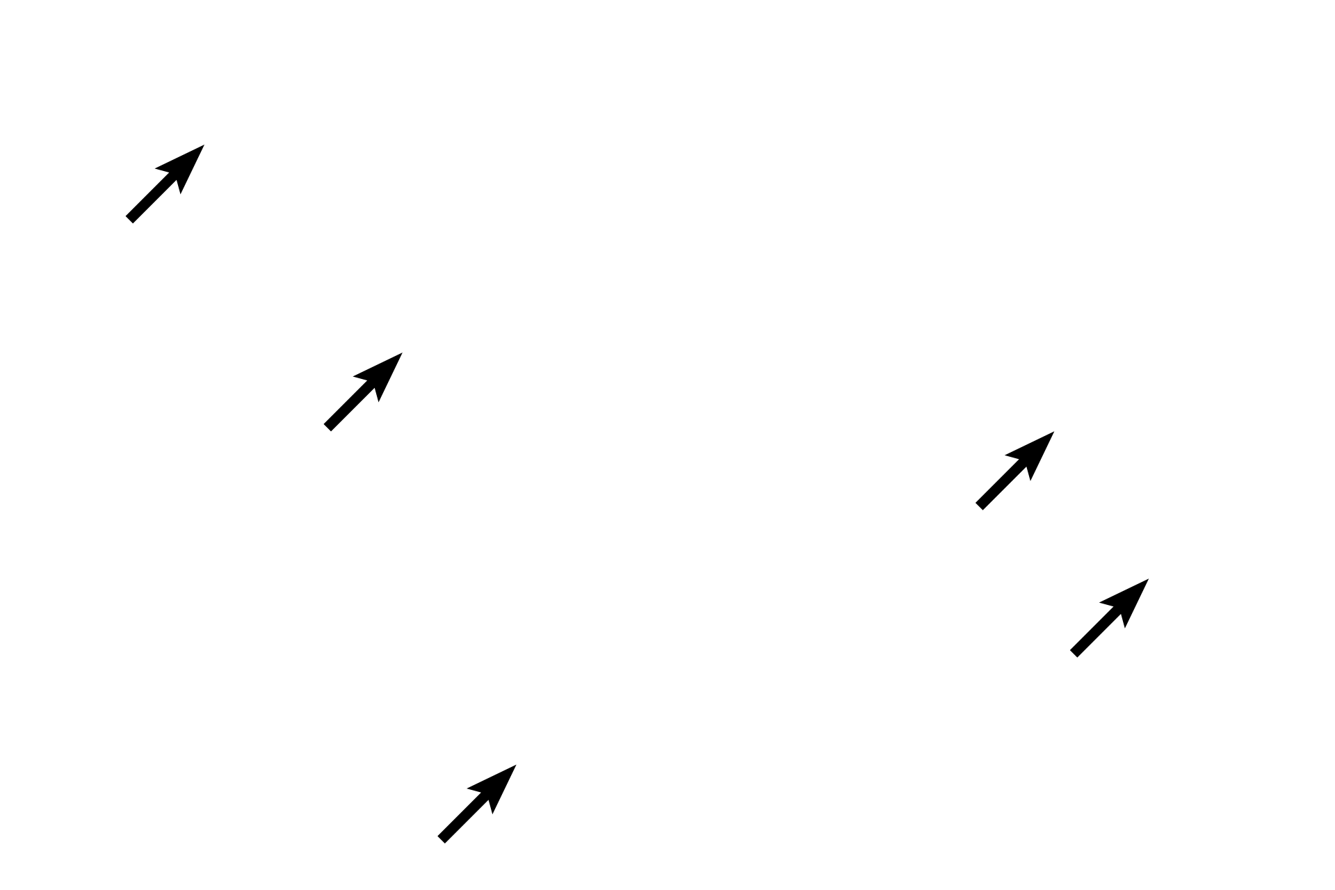 Howship's lacunae <p>The ruffled border consists of the highly folded plasma membrane on the bone-facing surface of an active osteoclast. The ruffled border creates a microenvironment into which the osteoclast secretes acid and proteases to dissolve and degrade the bone matrix, resulting in a Howship’s lacuna.</p>
