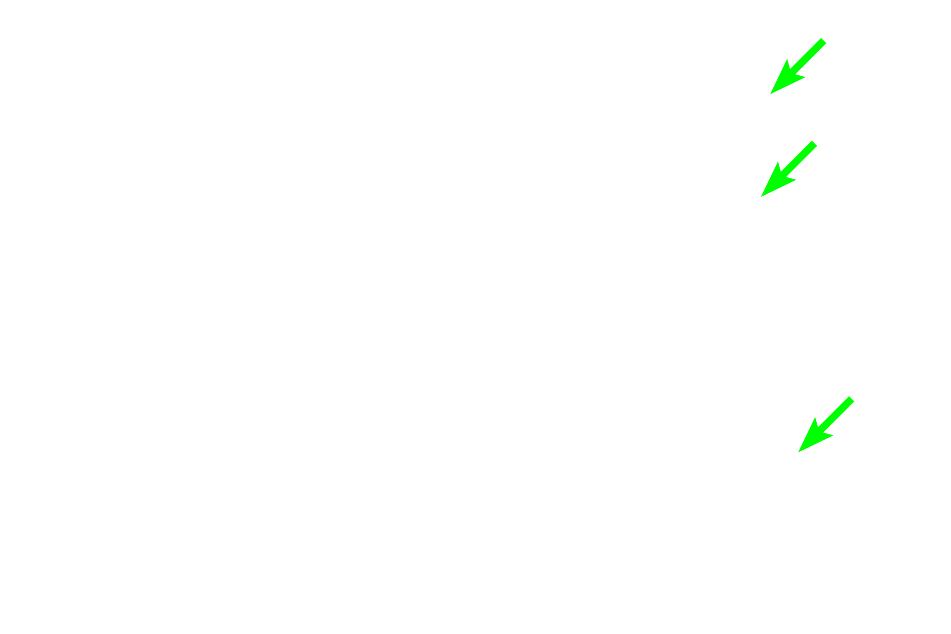 Endosteum <p>These images show osteoclasts on the surface of compact bone. Multinucleated osteoclasts are located in Howship’s lacunae that result from resorption of the bone matrix adjacent to the cell. The osteoclast on the left is located in the periosteum; the cells on the right are located in the endosteum. 800x, 600x </p>

