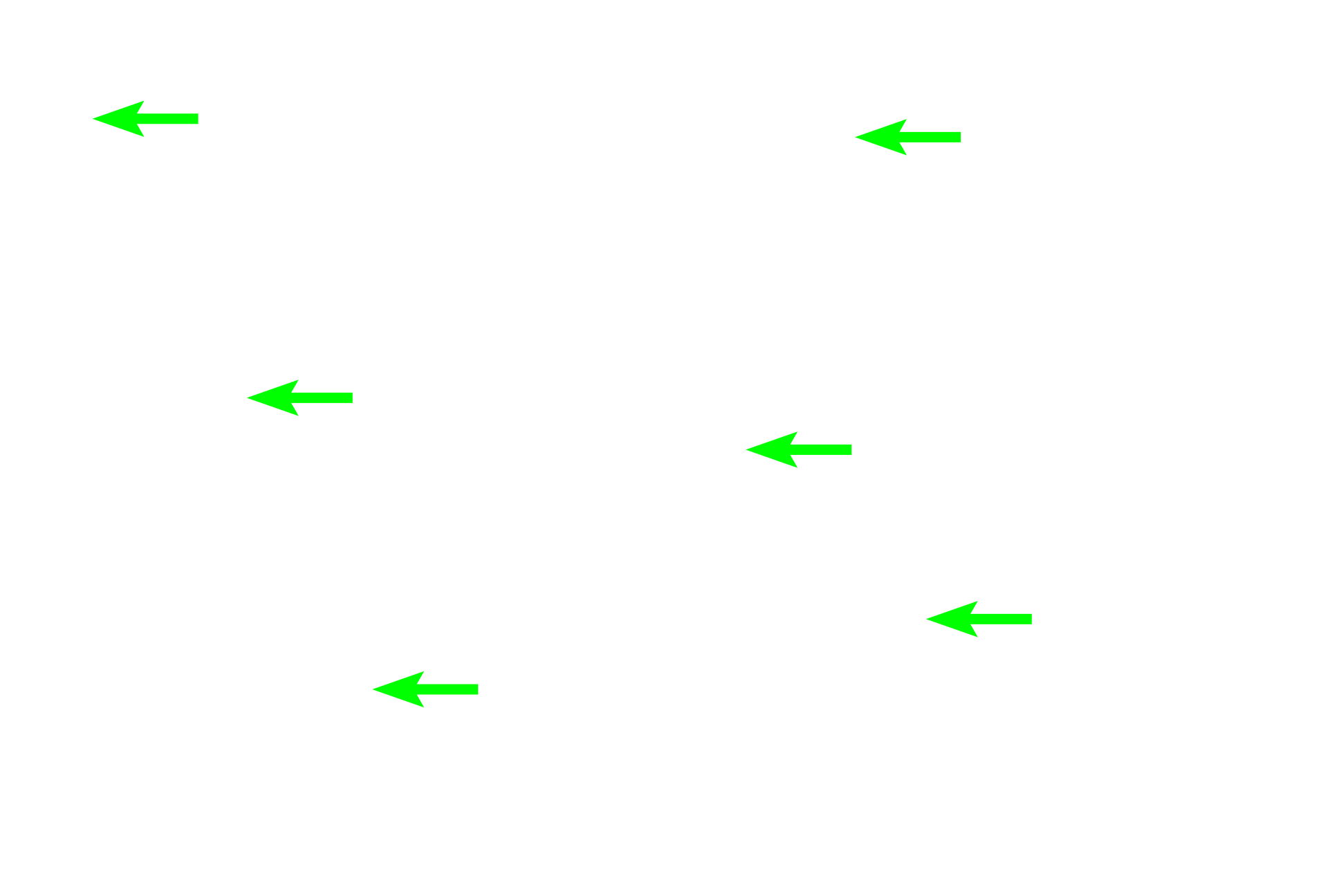 Osteocytes in lacunae <p>These images show osteoclasts on the surface of compact bone. Multinucleated osteoclasts are located in Howship’s lacunae that result from resorption of the bone matrix adjacent to the cell. The osteoclast on the left is located in the periosteum; the cells on the right are located in the endosteum. 800x, 600x </p>
