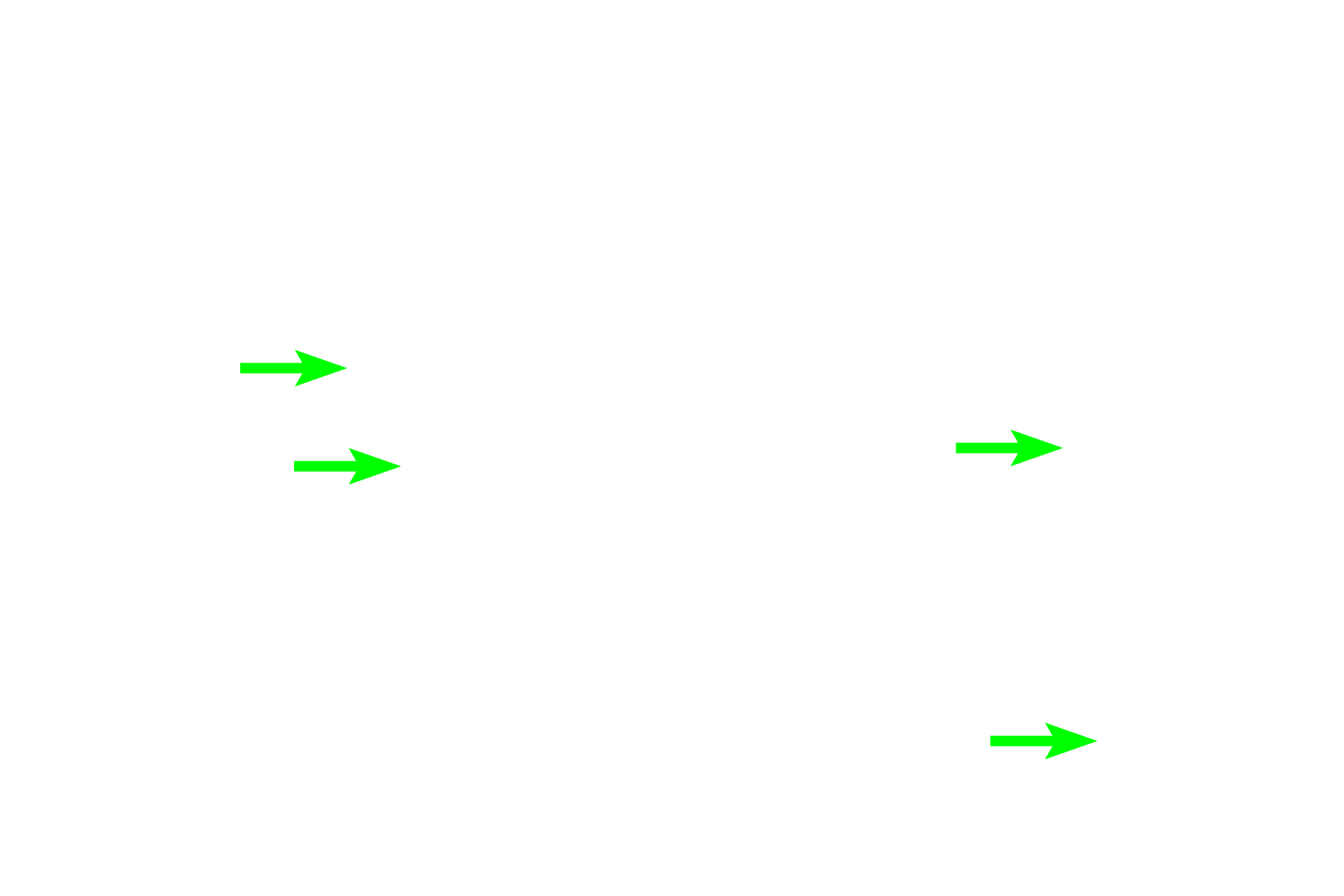  - Ruffled border <p>These images show osteoclasts on the surface of compact bone. Multinucleated osteoclasts are located in Howship’s lacunae that result from resorption of the bone matrix adjacent to the cell. The osteoclast on the left is located in the periosteum; the cells on the right are located in the endosteum. 800x, 600x </p>
