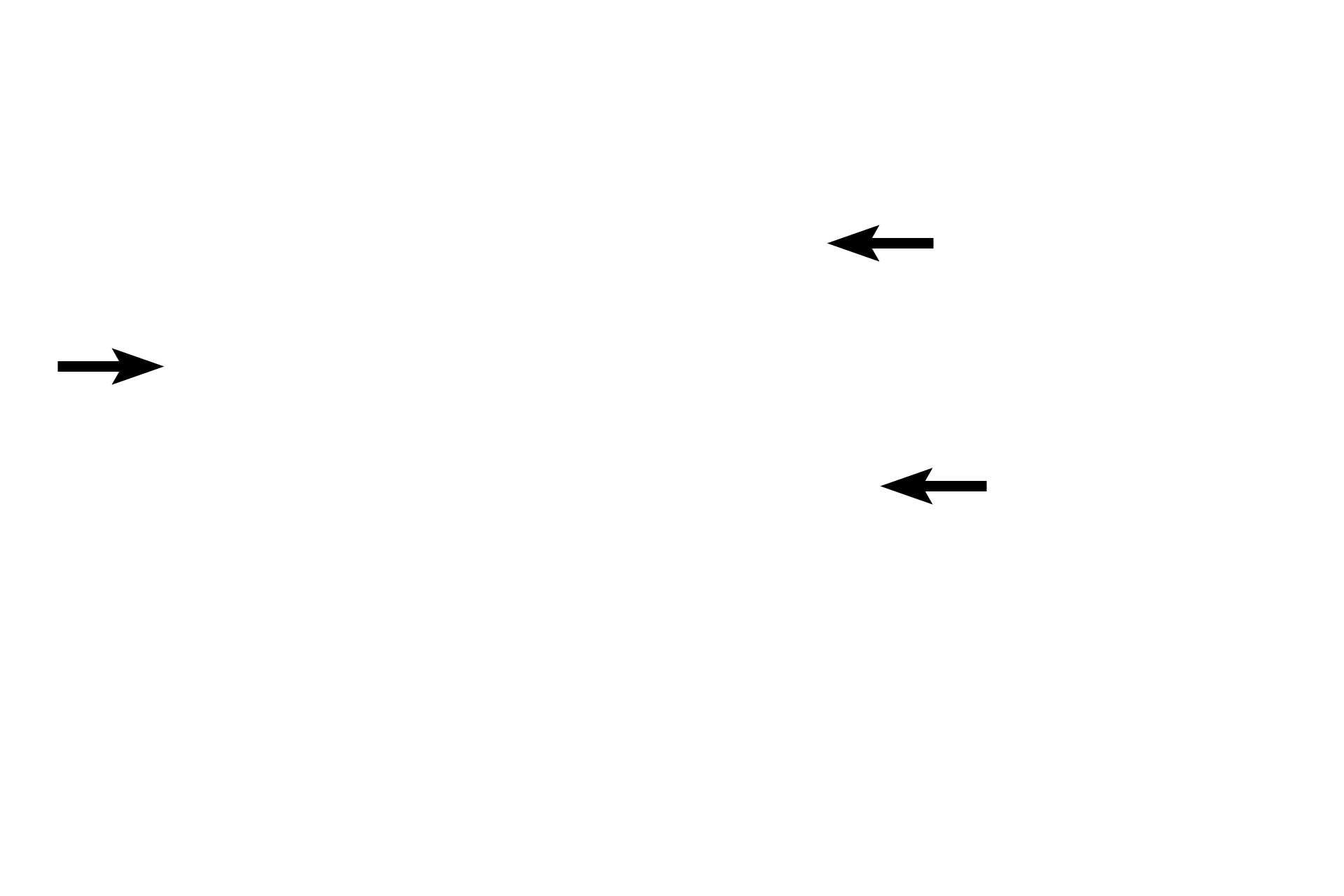  - Epithelium <p>In the duodenum, seen here, the submucosa also contains a mucus-secreting gland, named Brunner’s gland. This submucosal gland secretes an alkaline mucus that protects the intestinal mucosa from acidic gastric chyme. These glands are most numerous in the proximal regions of the duodenum. 40x </p>
