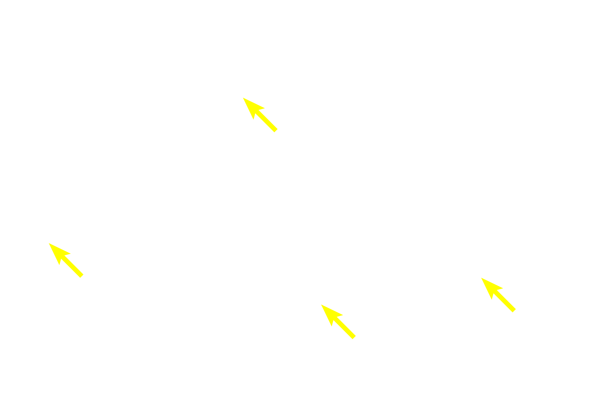  - Intestinal glands <p>In the duodenum, seen here, the submucosa also contains a mucus-secreting gland, named Brunner’s gland. This submucosal gland secretes an alkaline mucus that protects the intestinal mucosa from acidic gastric chyme. These glands are most numerous in the proximal regions of the duodenum. 40x </p>
