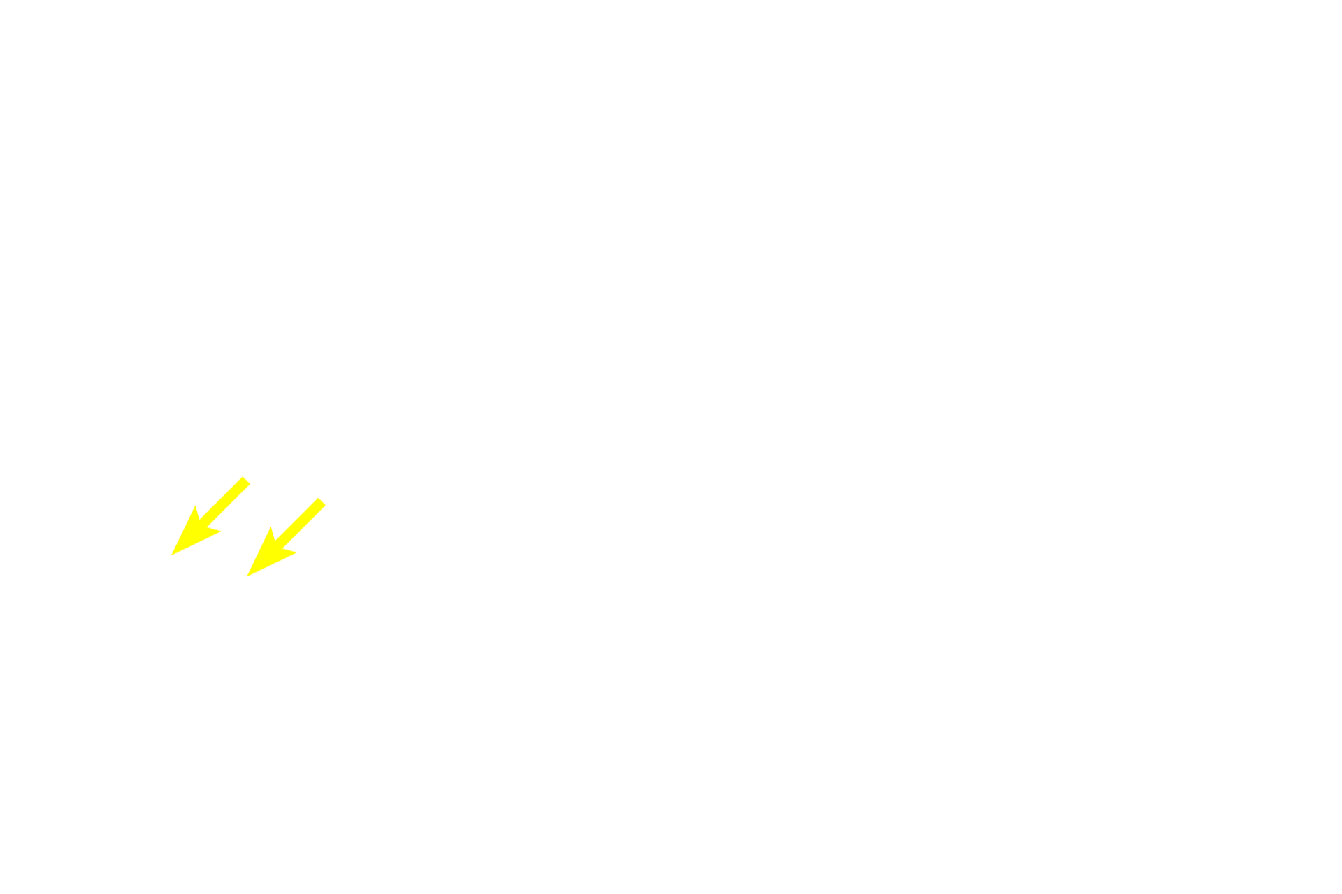  - MALT <p>In the duodenum, seen here, the submucosa also contains a mucus-secreting gland, named Brunner’s gland. This submucosal gland secretes an alkaline mucus that protects the intestinal mucosa from acidic gastric chyme. These glands are most numerous in the proximal regions of the duodenum. 40x </p>
