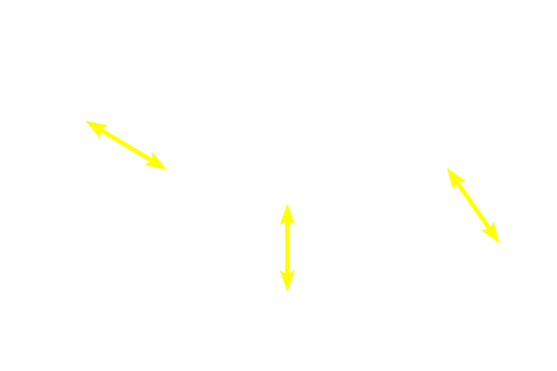 Mucosa <p>In the duodenum, seen here, the submucosa also contains a mucus-secreting gland, named Brunner’s gland. This submucosal gland secretes an alkaline mucus that protects the intestinal mucosa from acidic gastric chyme. These glands are most numerous in the proximal regions of the duodenum. 40x </p>
