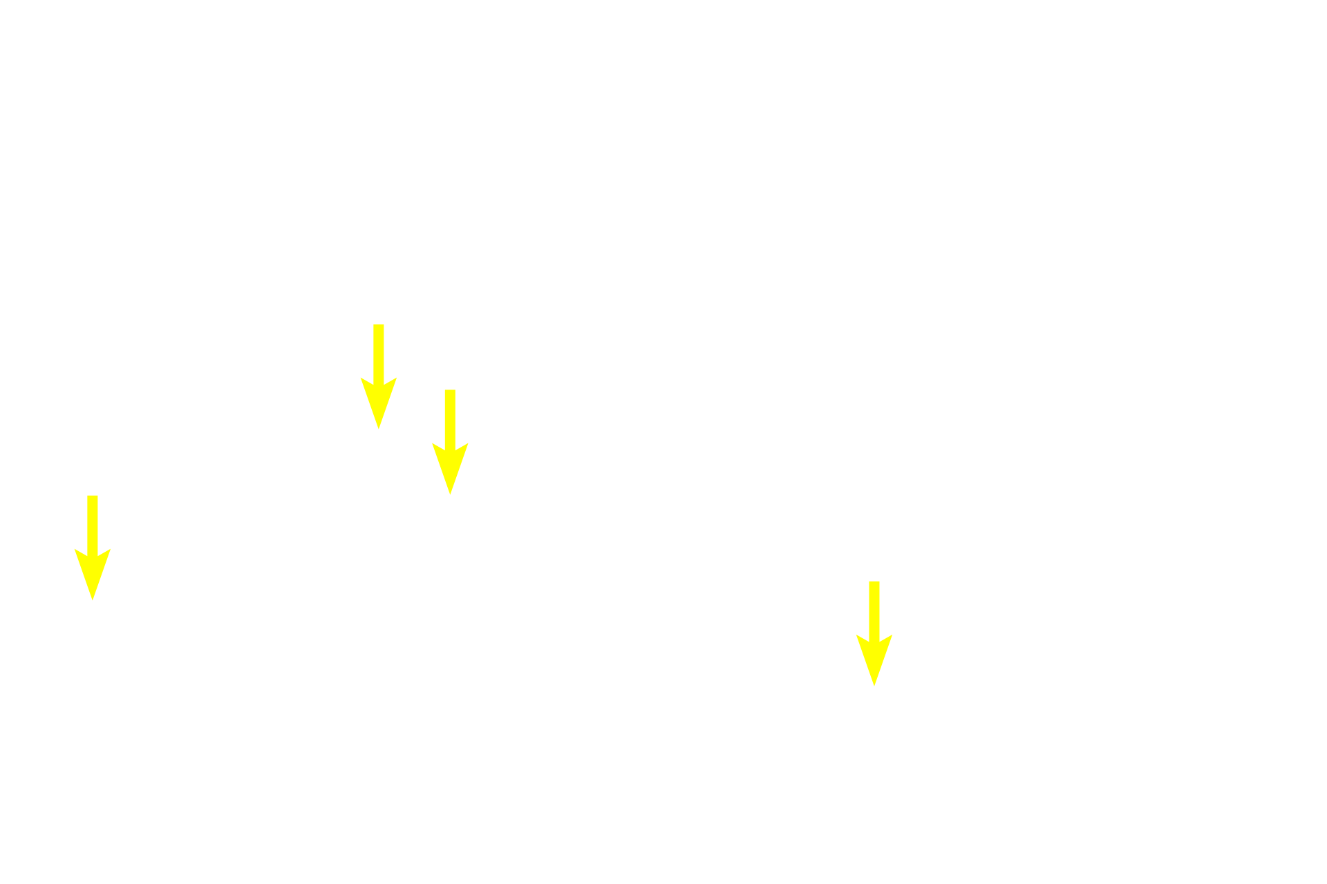  - Muscularis mucosae <p>In the duodenum, seen here, the submucosa also contains a mucus-secreting gland, named Brunner’s gland. This submucosal gland secretes an alkaline mucus that protects the intestinal mucosa from acidic gastric chyme. These glands are most numerous in the proximal regions of the duodenum. 40x </p>
