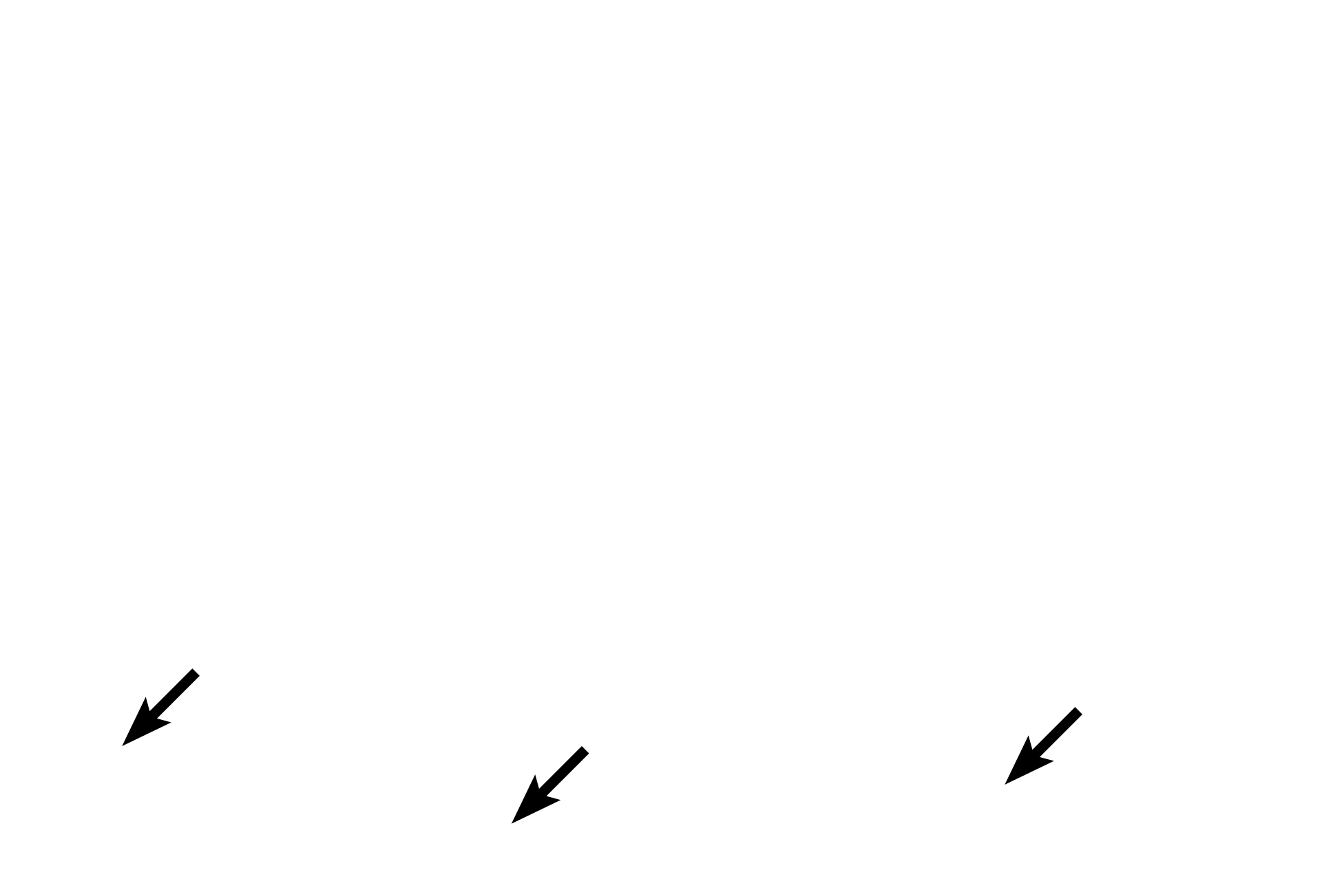  - Outer longitudinal layer <p>In the duodenum, seen here, the submucosa also contains a mucus-secreting gland, named Brunner’s gland. This submucosal gland secretes an alkaline mucus that protects the intestinal mucosa from acidic gastric chyme. These glands are most numerous in the proximal regions of the duodenum. 40x </p>
