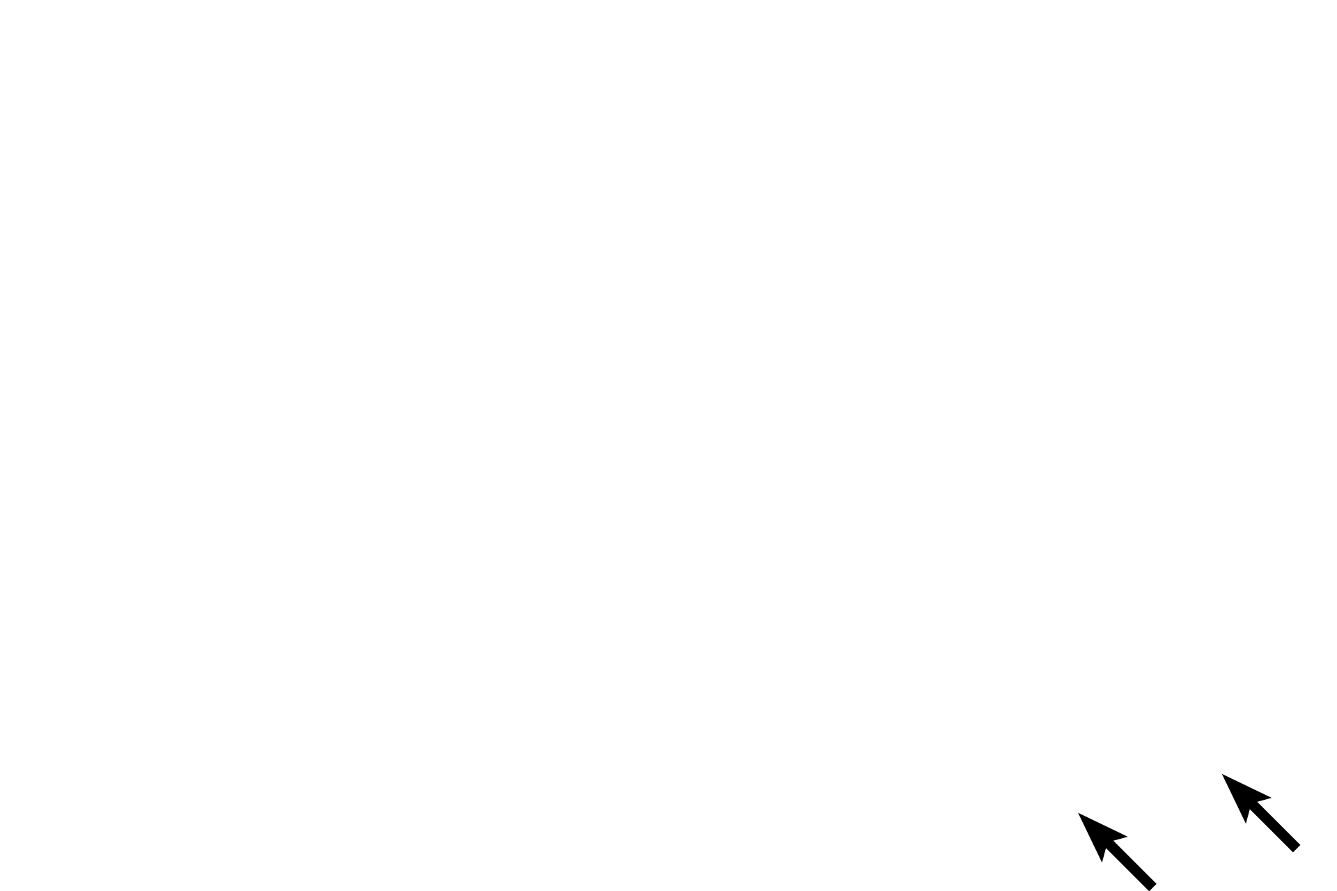 Serosa <p>The initial 2-3 centimeters of the duodenum is intraperitoneal, the remainder is retroperitoneal until it joins with the stomach. Both regions of the duodenum are visible in this section. The region to the left is retroperitoneal and thus only an adventitia is present. The intraperitoneal section is to the right and is covered by a serosa consisting of the adventitia along with the visceral peritoneum.</p>
