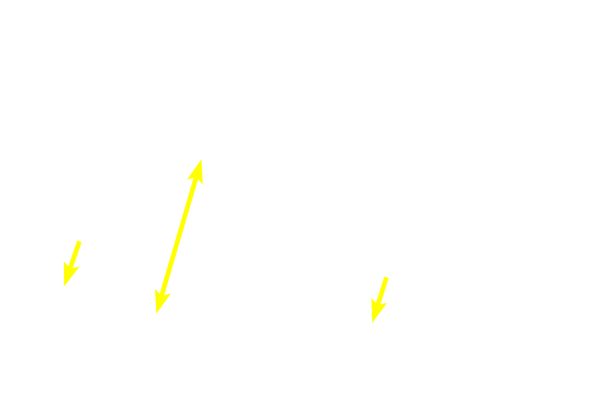 Submucosa <p>In the duodenum, seen here, the submucosa also contains a mucus-secreting gland, named Brunner’s gland. This submucosal gland secretes an alkaline mucus that protects the intestinal mucosa from acidic gastric chyme. These glands are most numerous in the proximal regions of the duodenum. 40x </p>
