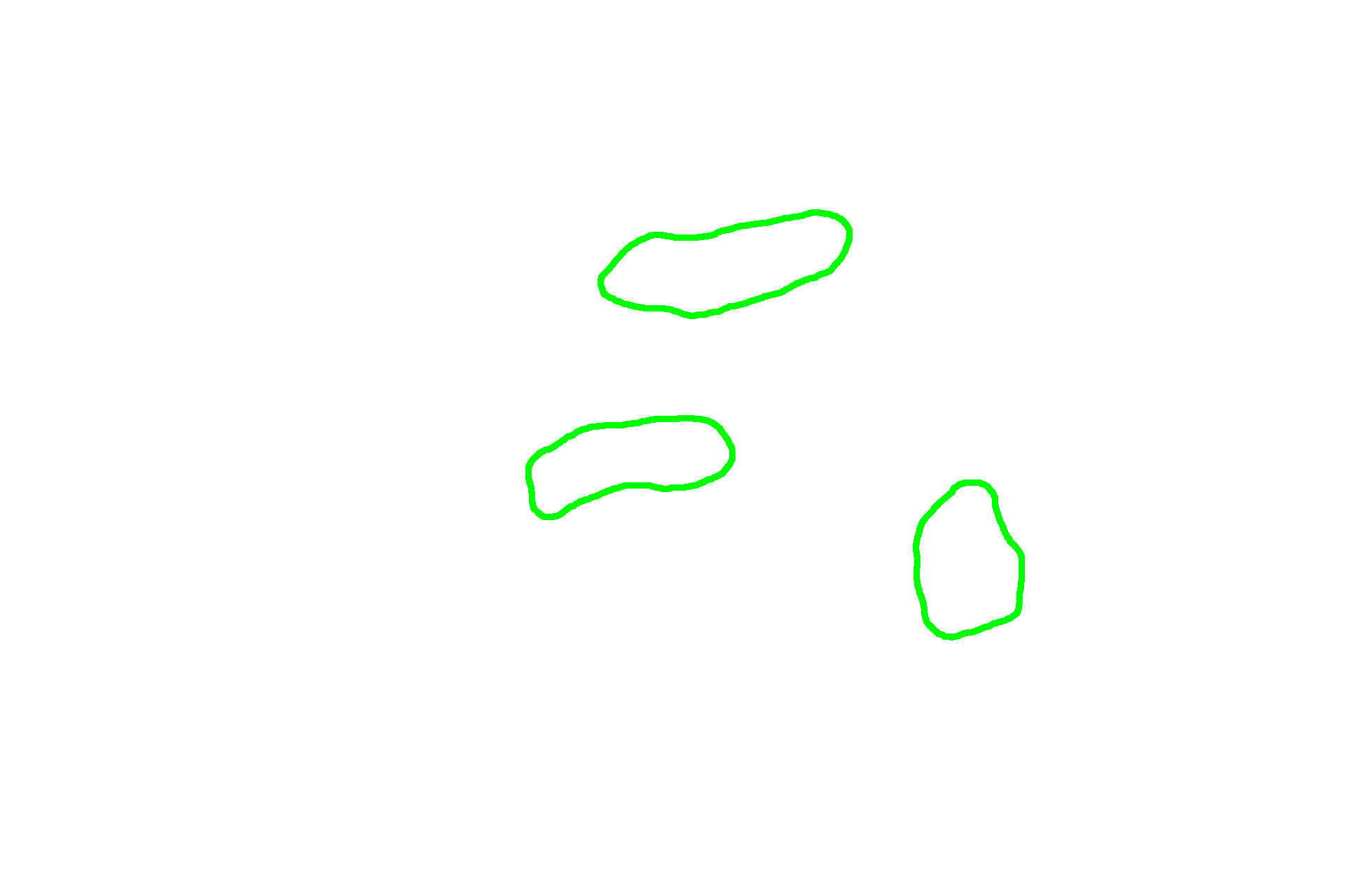  - Villi <p>In the duodenum, seen here, the submucosa also contains a mucus-secreting gland, named Brunner’s gland. This submucosal gland secretes an alkaline mucus that protects the intestinal mucosa from acidic gastric chyme. These glands are most numerous in the proximal regions of the duodenum. 40x </p>
