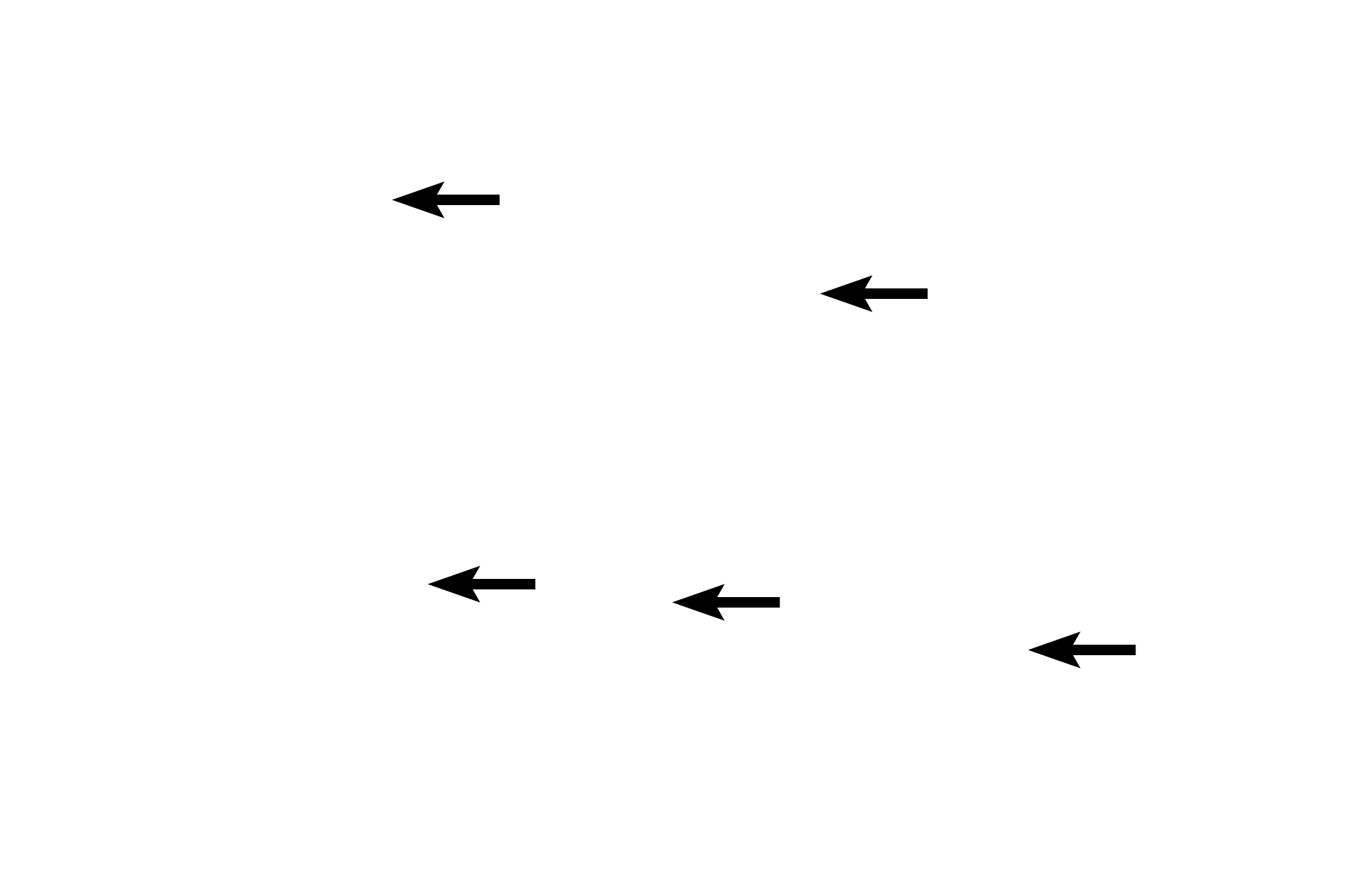 Haversian canals <p>A Volkmann’s canal is visible in this longitudinal section of decalcified cortical bone. Volkmann’s and Haversian canals convey blood vessels and both are lined by endosteum. Some cells visible in the lumens may also be those of endothelial cells lining blood vessels. 400x</p>
