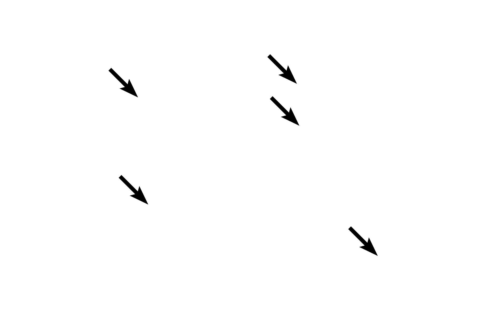 Endosteal cells <p>A Volkmann’s canal is visible in this longitudinal section of decalcified cortical bone. Volkmann’s and Haversian canals convey blood vessels and both are lined by endosteum. Some cells visible in the lumens may also be those of endothelial cells lining blood vessels. 400x</p>
