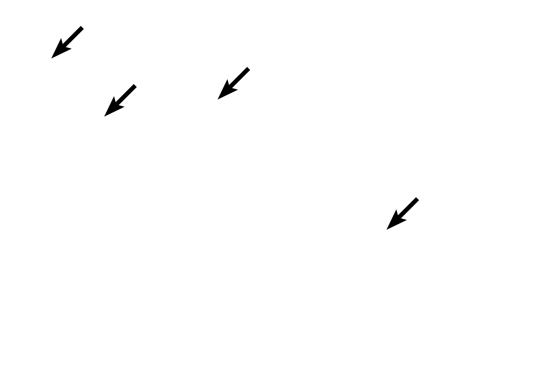 Osteocytes <p>A Volkmann’s canal is visible in this longitudinal section of decalcified cortical bone. Volkmann’s and Haversian canals convey blood vessels and both are lined by endosteum. Some cells visible in the lumens may also be those of endothelial cells lining blood vessels. 400x</p>
