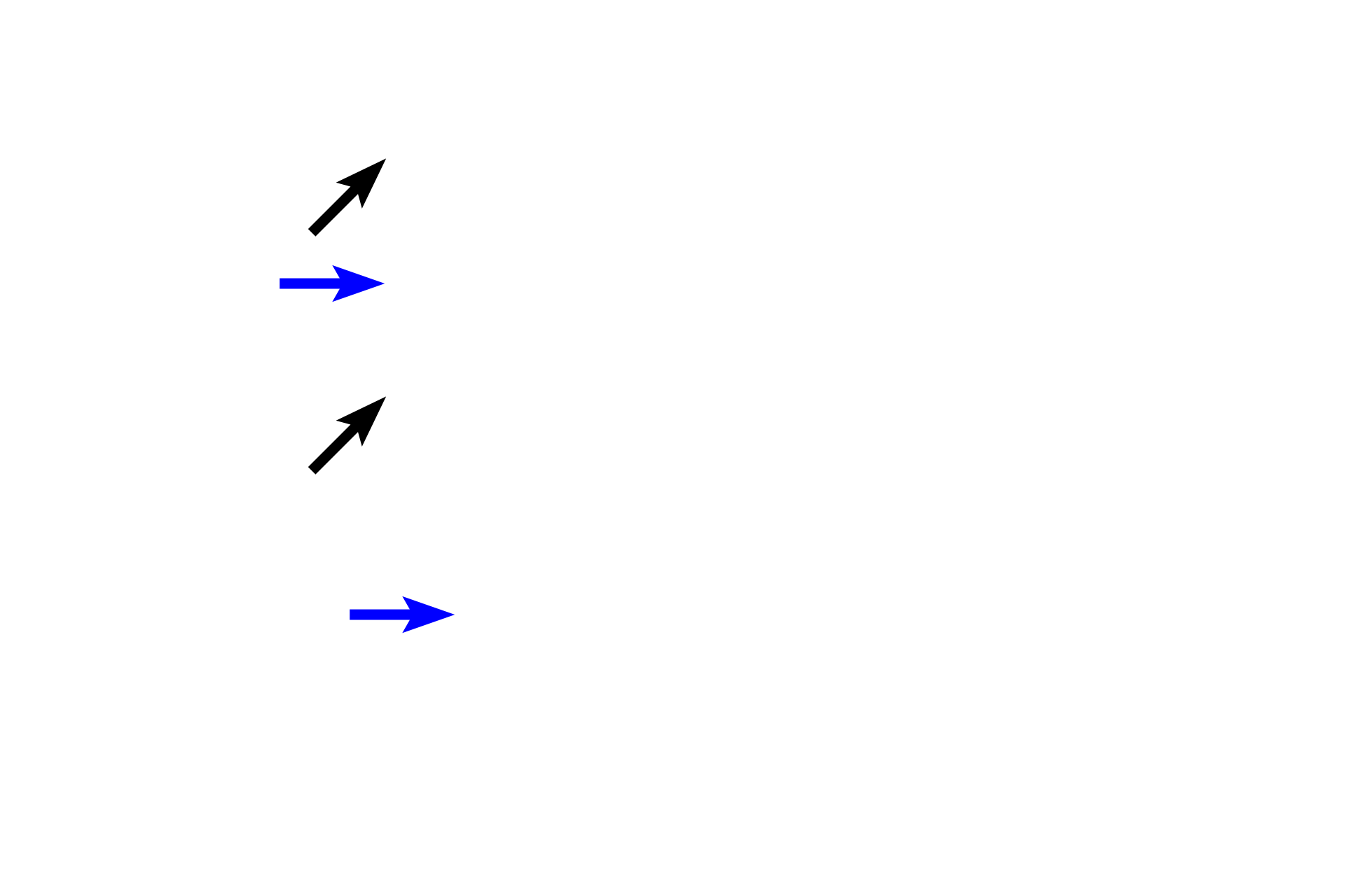 Epithelia > <p>Laryngeal epithelium varies depending on the stress it undergoes. Stratified squamous moist epithelium (black arrows) normally lines the epiglottis and the true vocal folds, areas that undergo continual stress. Respiratory epithelium (blue arrows), lining the remainder of the larynx, may be converted to stratified squamous moist in cases of irritation, such as in the larynx of a smoker. </p>
