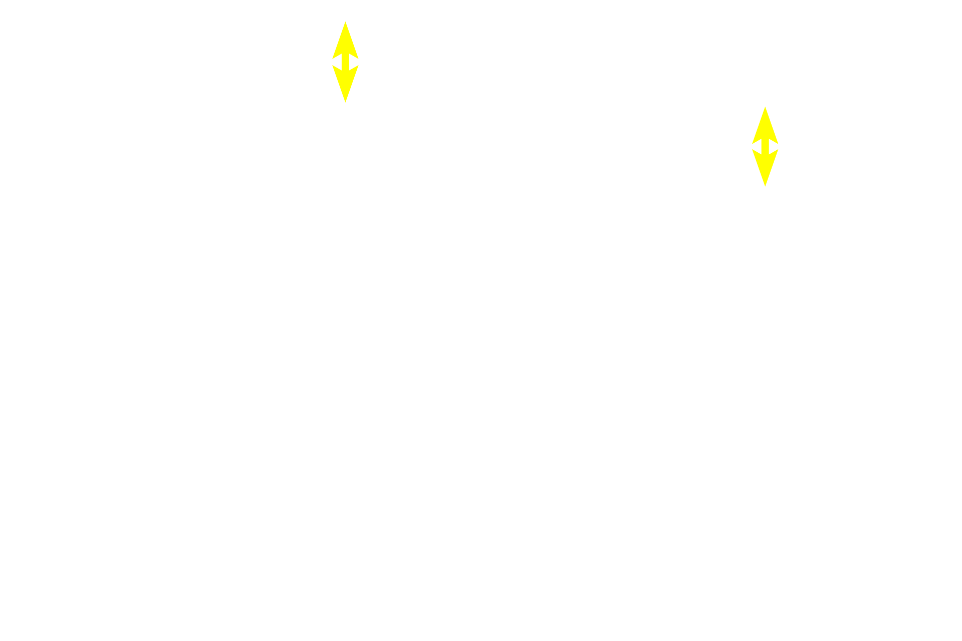 Epithelium >  <p>A tall pseudostratified columnar epithelium with cilia and goblet cells lines the trachea and primary bronchi.</p>
