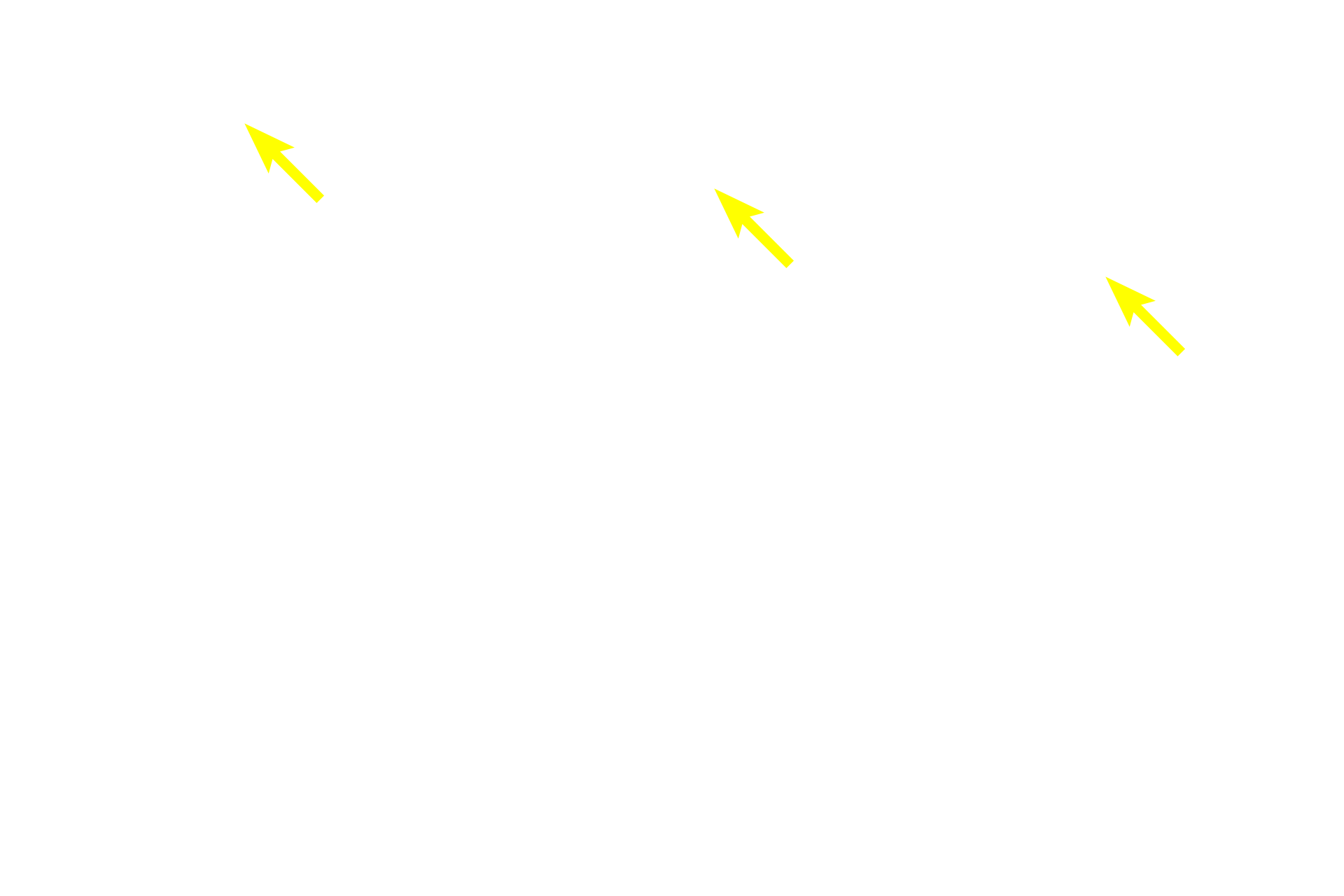 Basement membrane >  <p>A prominent basement membrane is typical for these two passageways.</p>
