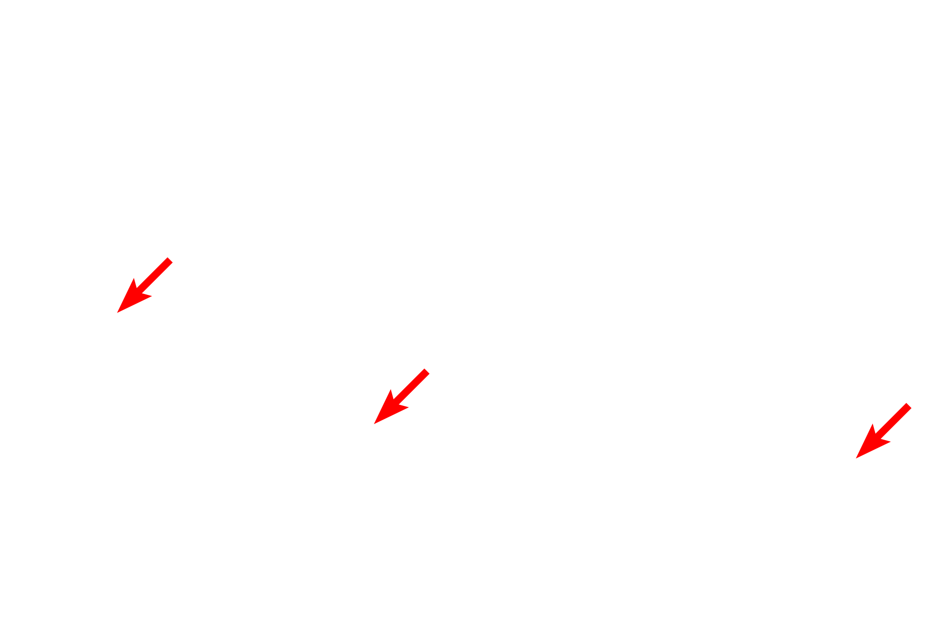  - Mucous component <p>Mixed glands, located in the submucosa, secrete both mucous and serous products. Their secretions moisten the surface of the epithelium as well provide a coating for these passageways that entrap inhaled dust and other particulate matter.</p>
