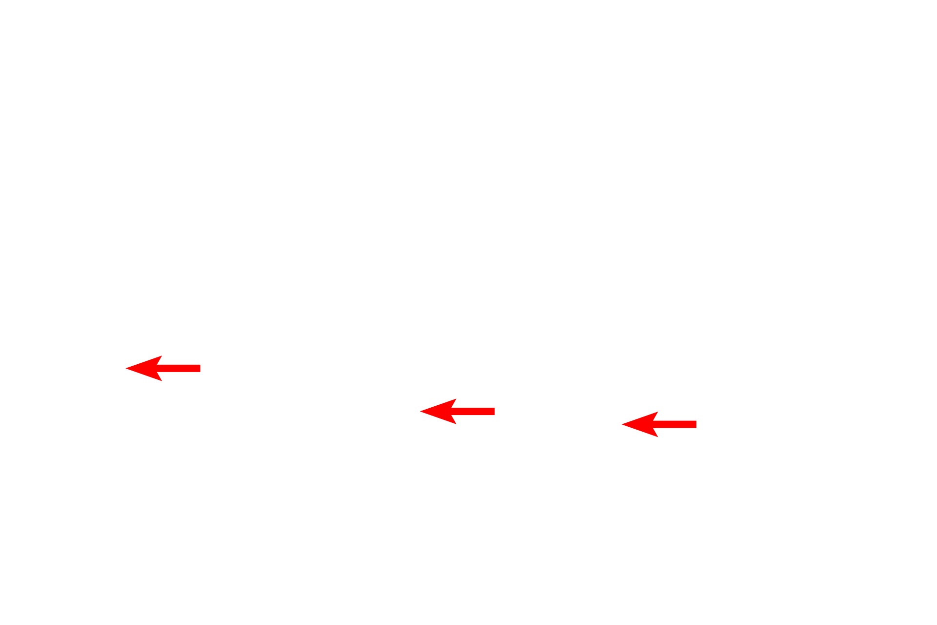  - Serous component <p>Mixed glands, located in the submucosa, secrete both mucous and serous products. Their secretions moisten the surface of the epithelium as well provide a coating for these passageways that entrap inhaled dust and other particulate matter.</p>
