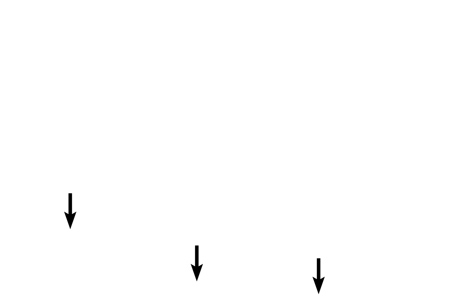 Perichondrium <p>Patency of the trachea and primary bronchi is maintained by a series of hyaline cartilage rings. A perichondrium surrounds this tissue.</p>
