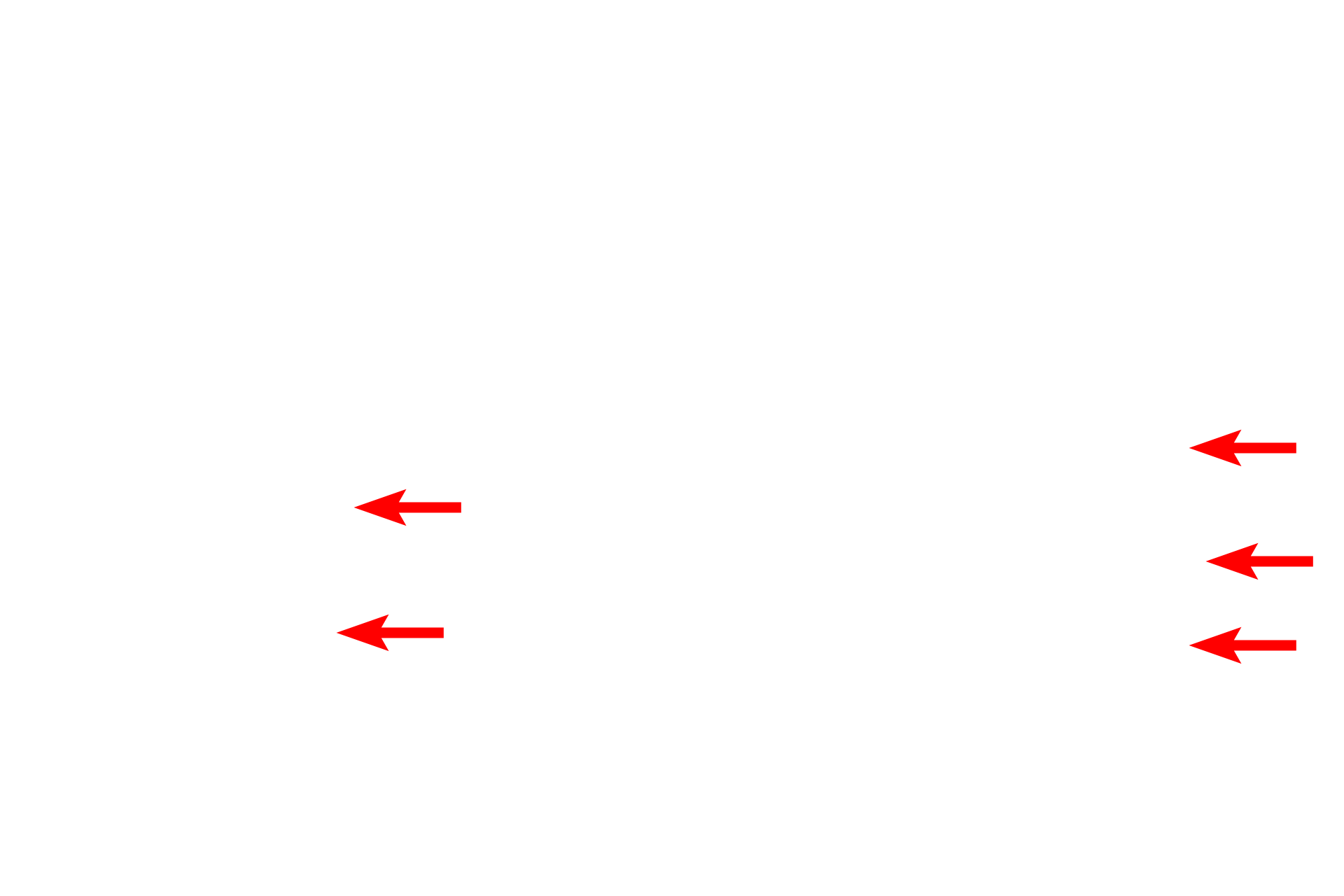 Pharynx <p>Respiratory passages located outside the lung are referred to as extrapulmonary.  These frontal and mid-sagittal views of the head and neck illustrate the extrapulmonary components of the conducting portion of the respiratory system.  The inset shows the trachea dividing into two primary bronchi (in red), one supplying each lung.</p>
