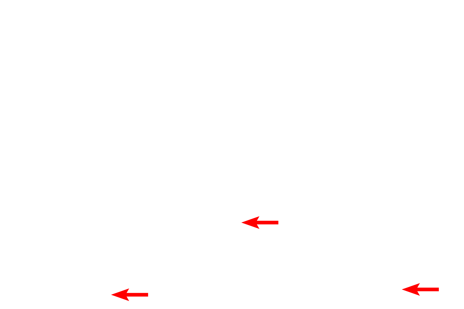 Trachea <p>Respiratory passages located outside the lung are referred to as extrapulmonary.  These frontal and mid-sagittal views of the head and neck illustrate the extrapulmonary components of the conducting portion of the respiratory system.  The inset shows the trachea dividing into two primary bronchi (in red), one supplying each lung.</p>
